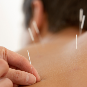 Trouver les points d&rsquo;acupuncture sans connaissance des méridiens comme une méthode idéale pour rétablir l&rsquo;harmonie au sein du flux d’énergie du corps.